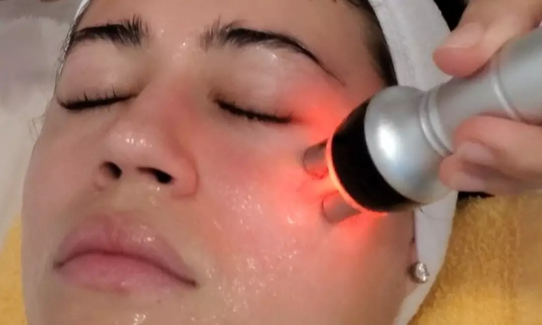 Up to 47% Off on Radio Frequency Skin Tightening at Brizida  Aesthetics - Primary Image