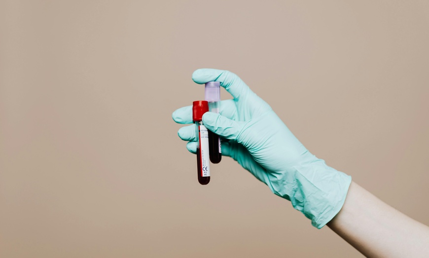 Image 5: Transform Your Hair with One or Three PRP Hair Restoration Sessions