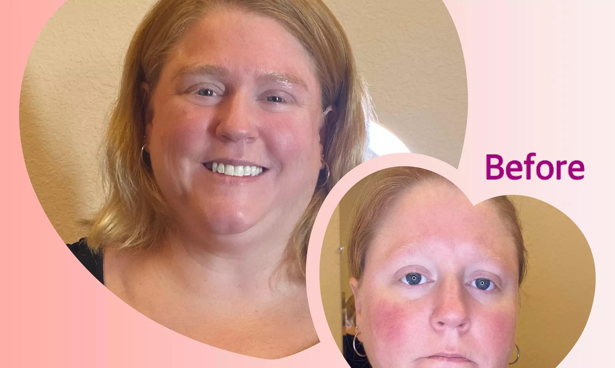 Up to 58% Off on Permanent Makeup at Brow Remedy LLC - Primary Image