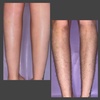 Image 3: Up to 30% Off on Waxing at The Reveal Studio