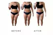 Precision Slim Laser Fat Loss & Skin Tightening – Non-Invasive Body Contouring Up to 58% Off at Your Sculpt Studio DC - Second Medium