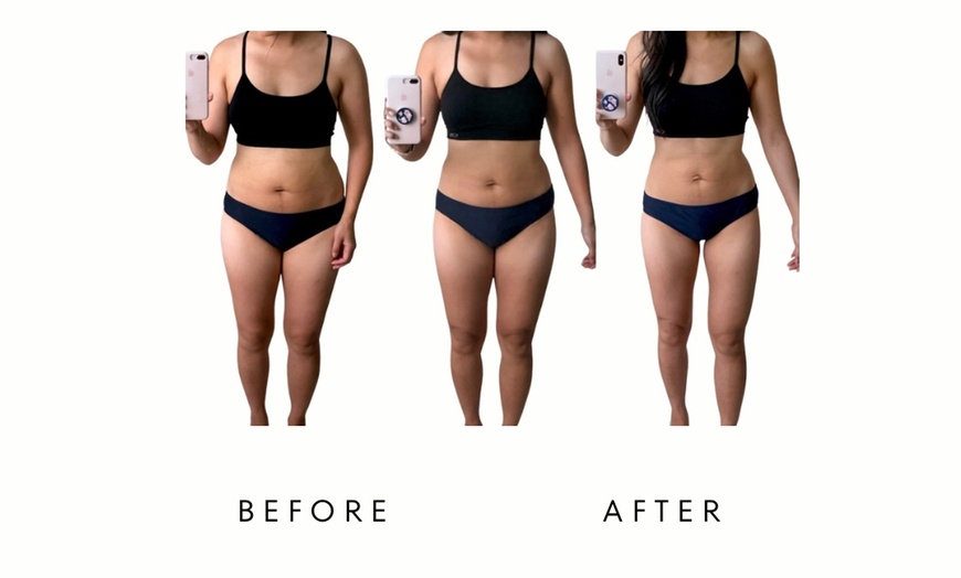 Image 3: Precision Slim Laser Fat Loss & Skin Tightening, Your Sculpt Studio DC