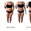 Image 3: Precision Slim Laser Fat Loss & Skin Tightening, Your Sculpt Studio DC