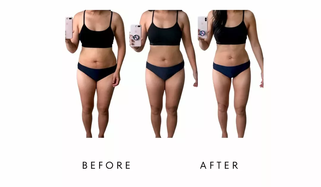 Precision Slim Laser Fat Loss & Skin Tightening, Your Sculpt Studio DC