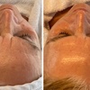 Image 6: Premium Glow-Facial inkl. Wickeltherapie & MatrixxFace für 1 Person