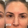 Image 2: Up to 65% Off on Injection - Botox at Nude Aesthetics