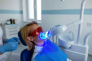 Blanchiment dentaire 45 min pour un sourire plus blanc et éclatant chez Sofya Beauty (jusqu'à 57% de remise)