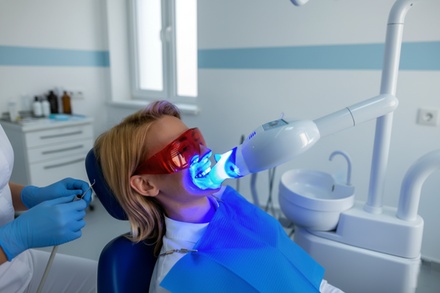 1 séance de blanchiment dentaire de 45 min - Sofya Beauty