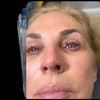 Image 2: Up to 30% Off on Eyelash Perm at Hang's Spa