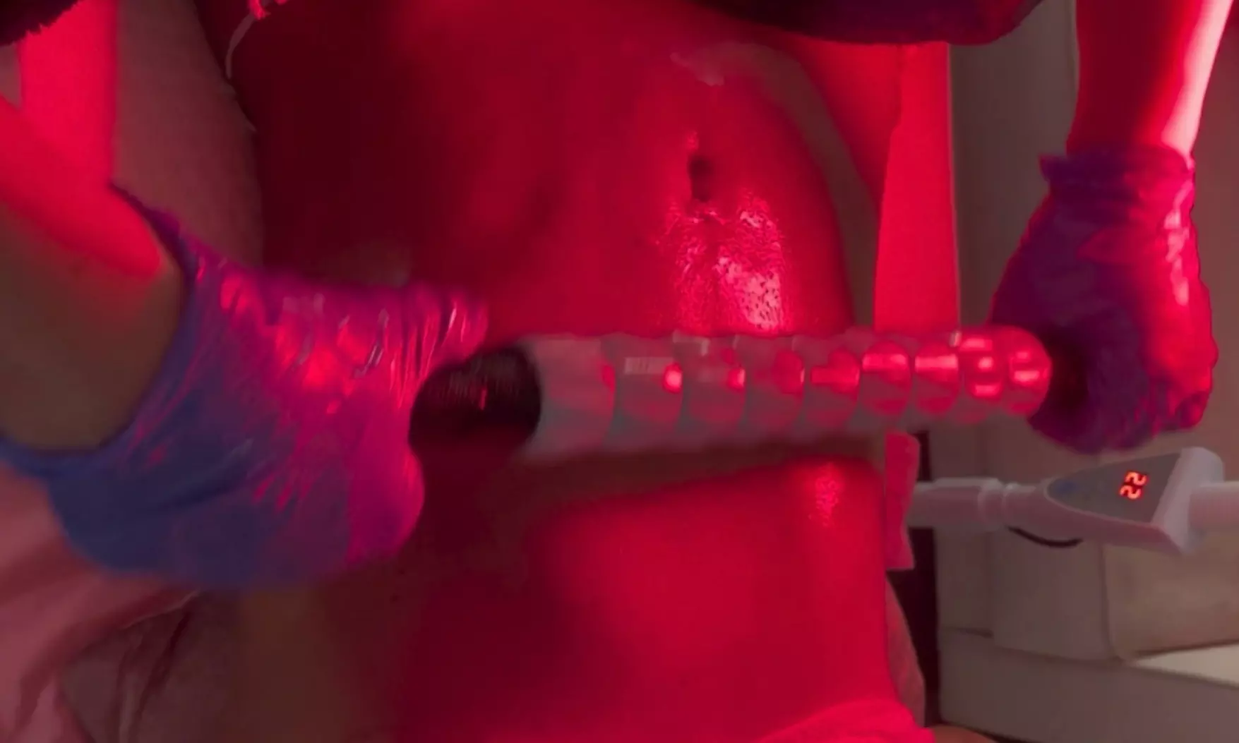 Post Op Drainage Treatments for Healing and Comfort