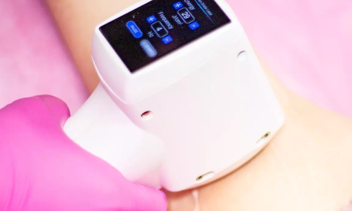 Depilacja laserowa wybranych partii ciała dla kobiet i mężczyzn