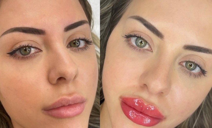 Image 6: Effortless Beauty with Ombre Brows or Lip Blush Session