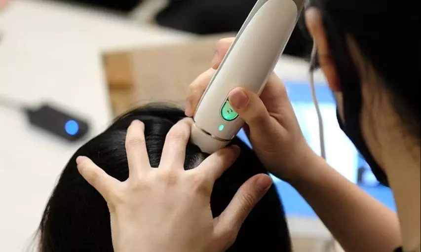 Reveal Scalp Issues with a Professional Detection Analysis 