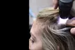 Hair, Scalp Analysis and Take Home Product with Optional Treatment and Blowdry at Folli RX (Up to 50% Off) - Second Medium