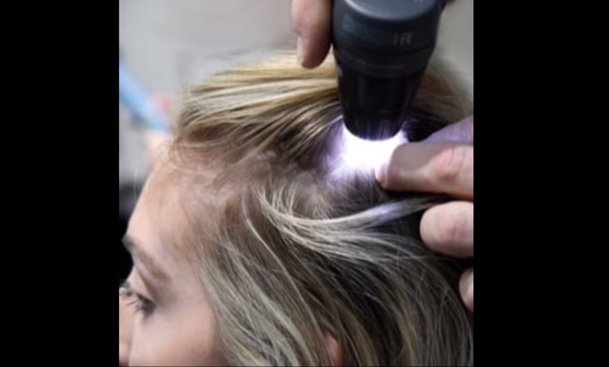 Image 2: Hair, Scalp Analysis and Take Home Product with Optional Treatment