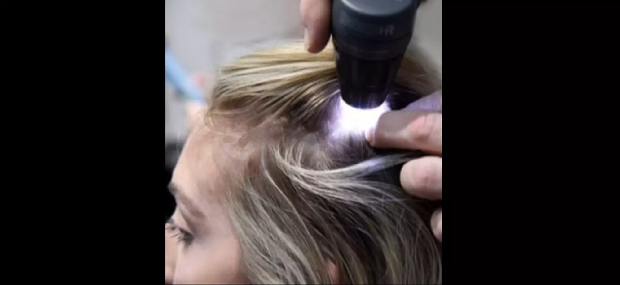 Hair, Scalp Analysis and Take Home Product with Optional Treatment