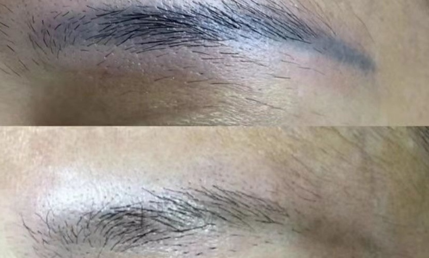 Image 2: Eyebrows Microblading & Tattoo Removal with Advanced Pico Laser