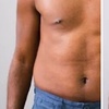 Image 1: Up to 55% Off on Coolsculpting at Florida Cosmetic Center