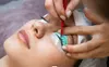 Up to 45% Off on Spa / Salon Beauty Treatments at Idyllwild Aesthetics