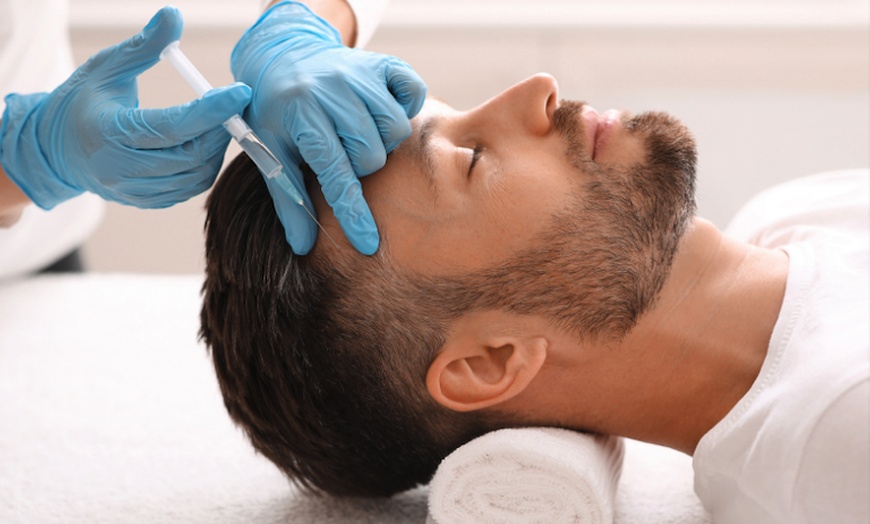 Image 1: 30 Min. PRP-Behandlung für Kopfhaut zur Anregung des Haarwachstums
