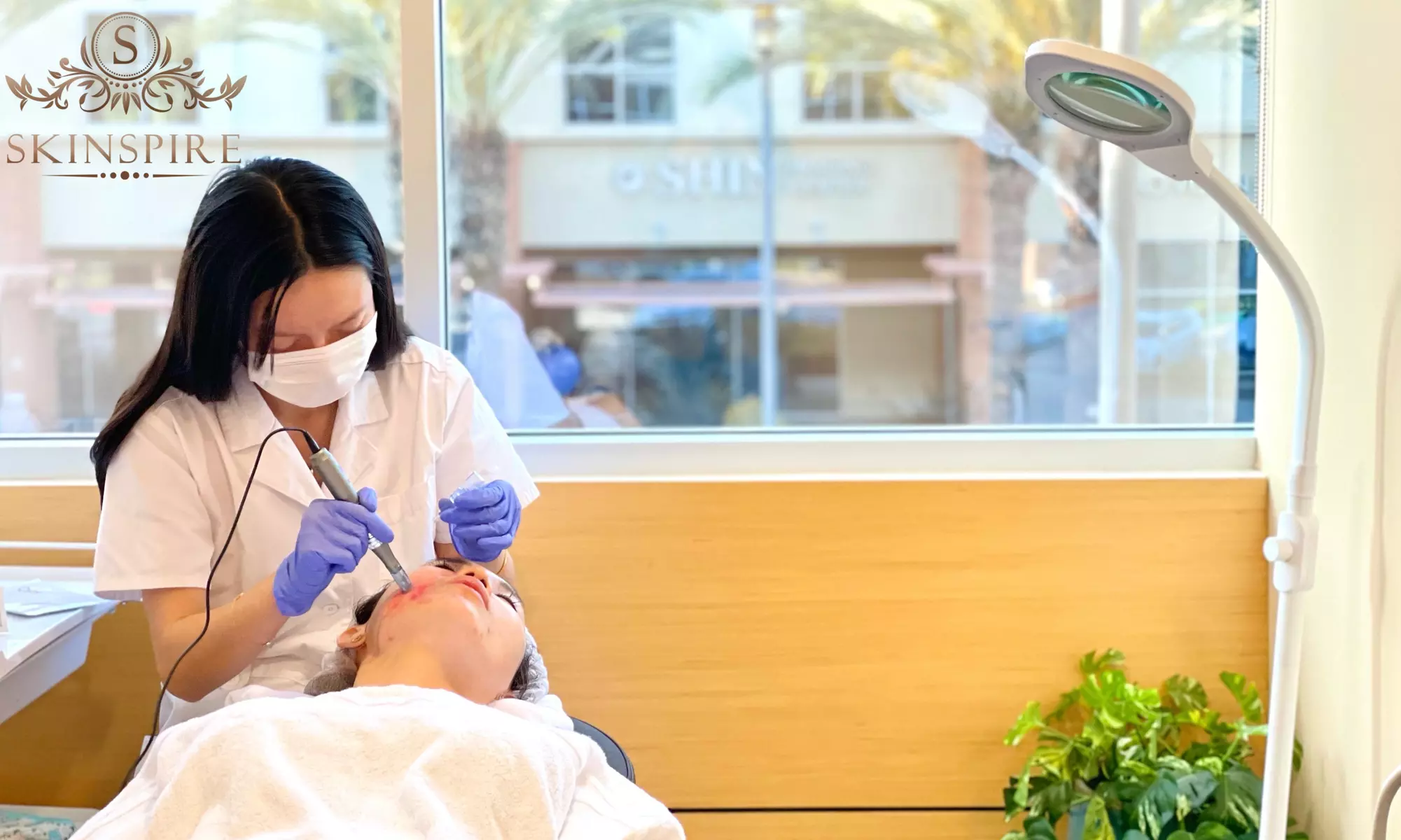 Revitalize Skin with Microneedling Acne Treatments