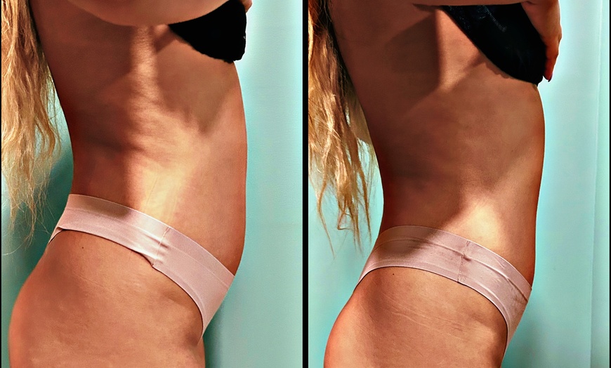 Image 1: Up to 43% Off on Cavitation at Beauty By Gauthier