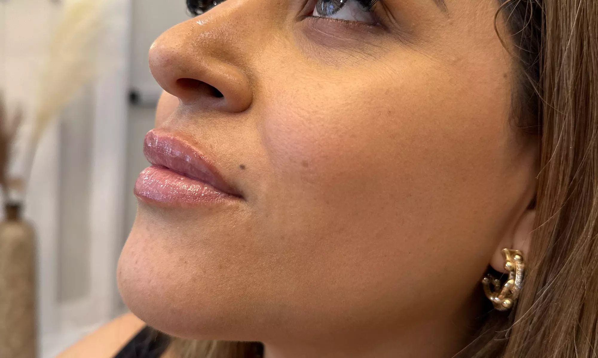 20, 40 or 60 Units of Botox or 1 ML Syringe Versa