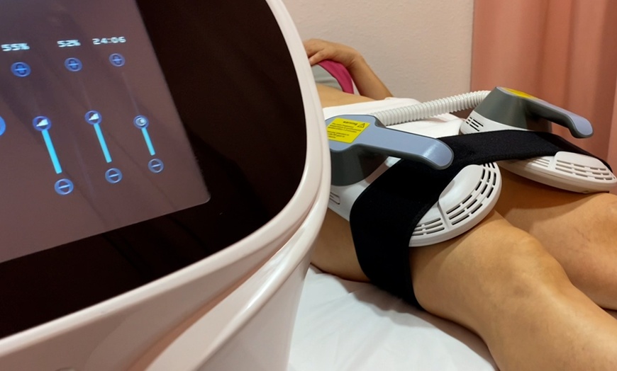 Image 3: Achieve Visible Results With One, Three or Six Cavitation Sessions