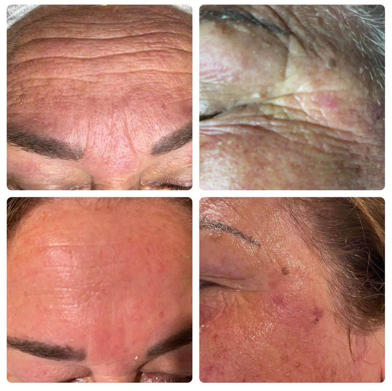 Experience the Gold Protein Threads Treatment for Radiant Skin