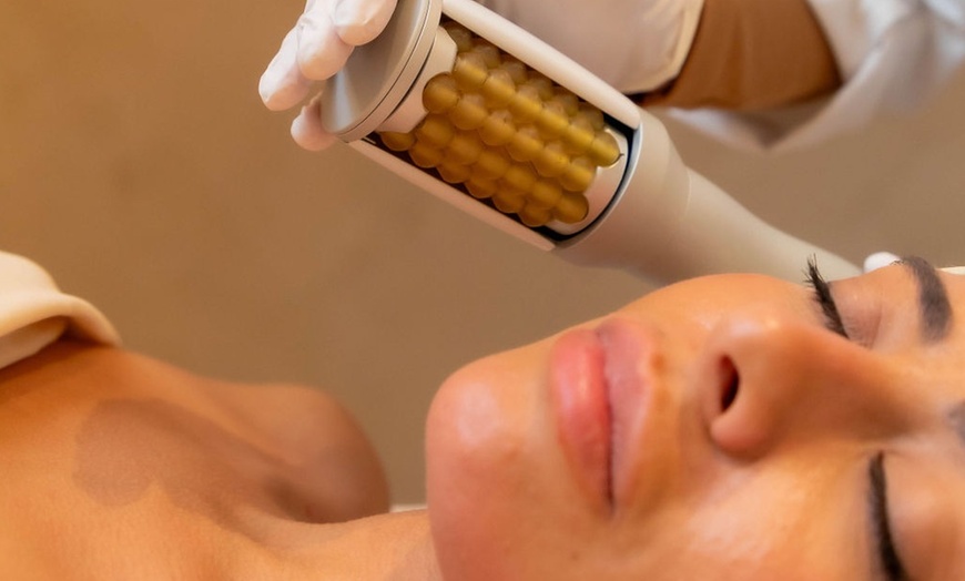Image 1: Enhance Your Radiance with Endospheres Therapy Body or Face and Neck