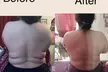 Up to 51% Off on Lymphatic Drainage Massage at Shaped Beautifully - Second Medium
