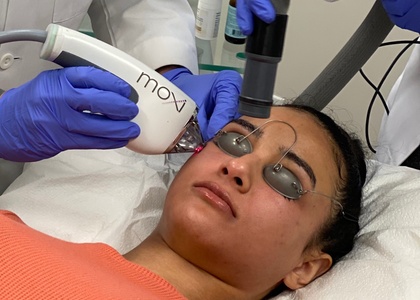 One MOXI Laser Resurfacing Treatment - Bella Bliss Med Spa