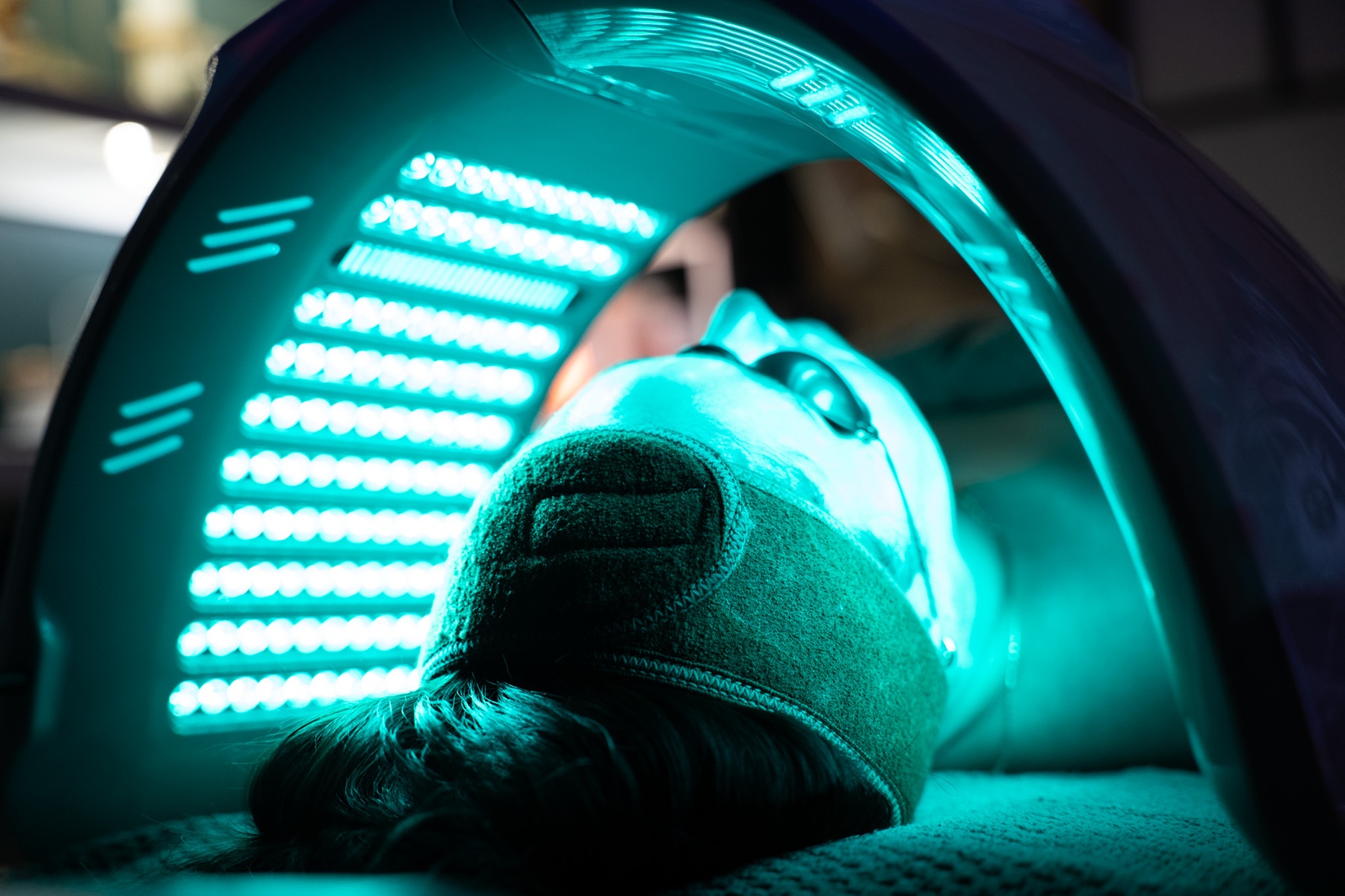 Up to 64% Off on Microdermabrasion at Bonafide Dreams