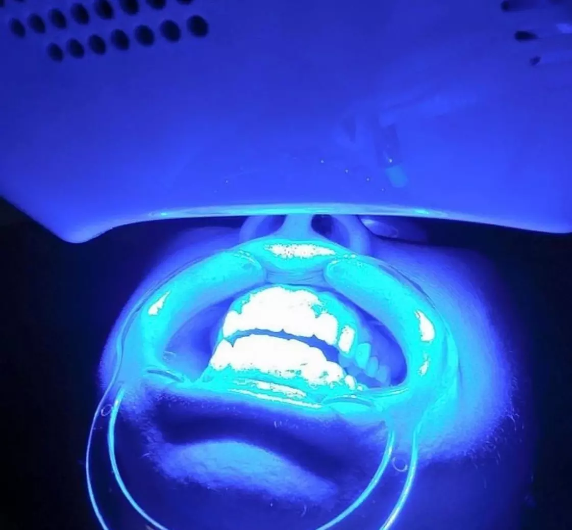 Get a Brighter Smile with Basic or Deluxe Whitening