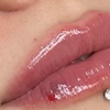 Image 1: Stunning Lips Awaits with 0.5 or 1 ml of Russian Lips Dermal Filler