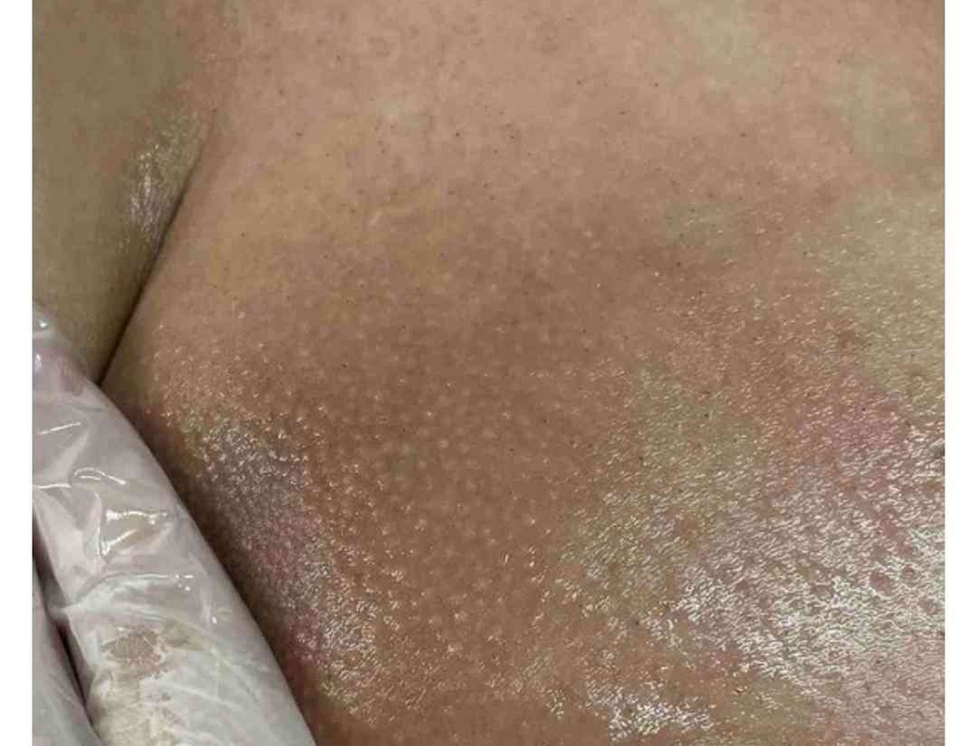 Up to 52% Off on Brazilian / Bikini Waxing at Renew Beauty services & Boutique