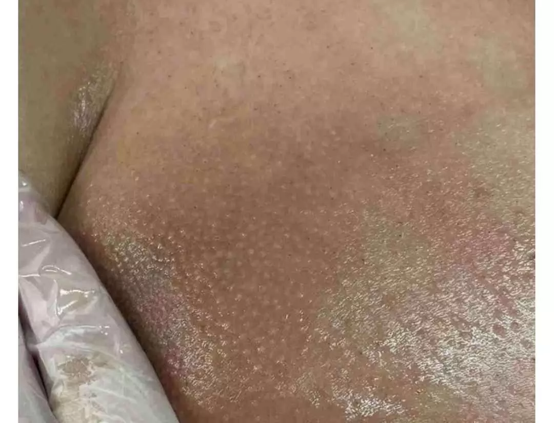 Up to 52% Off on Brazilian / Bikini Waxing at Renew Beauty services & Boutique - Primary Image