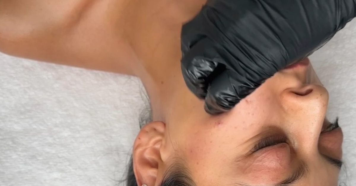 Buccal Facial Massage with Sculpting & Lifting Benefits at Body Bliss Co in North Central San Antonio