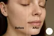 Microneedling Facial with Hydrating Mask & Serum at KBrows (Up to 51% Off) - Image 2