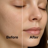 Image 2: Revitalize Skin with Full Face Micro Need Needling Treatment at Kbrows