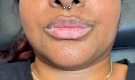 0.5 ML Microneedle Lip Filler Injection - Hilenda's Alluring Makeup