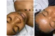 Experience rejuvenating in spa facials at The Wright Esthetics with options for up to 49% off. - Second Medium