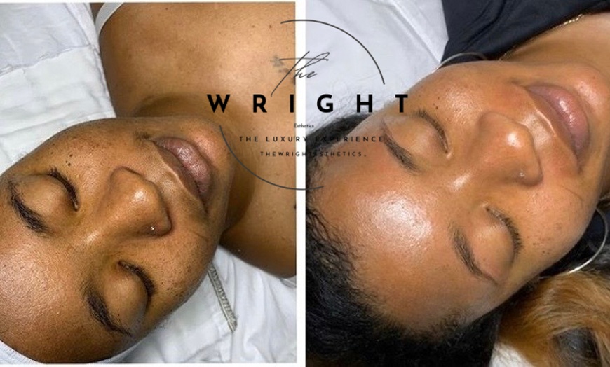 Image 4: Experience rejuvenating in spa facials at The Wright Esthetics with options for up to 49% off.