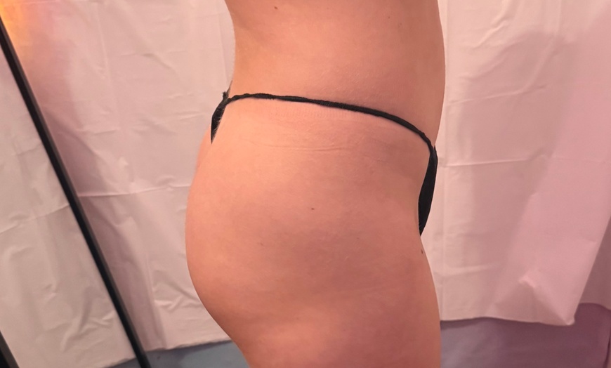 Image 1: Up to 62% Off on Lipo - Non-Invasive Laser-iLipo at Dolly's Beauty Enterprise