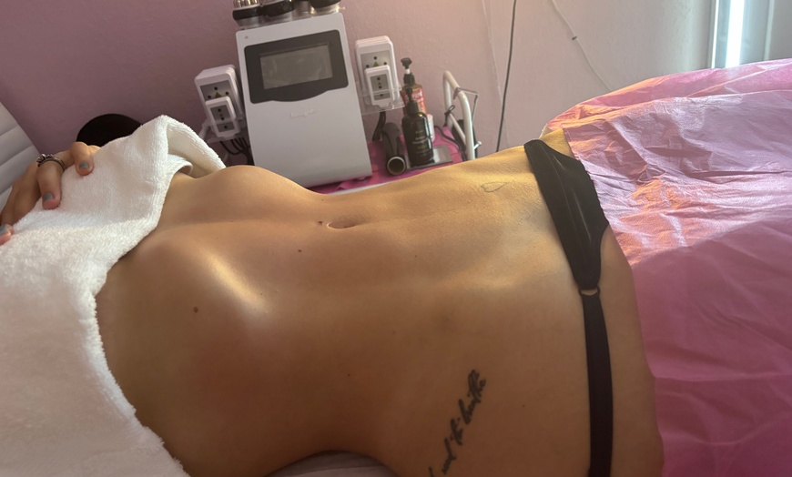 Image 2: 60min Body Countoring with Wood Therapy, Cellulite Treatment and More