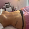 Image 2: 60min Body Countoring with Wood Therapy, Cellulite Treatment and More