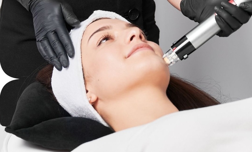 Image 1: Up to 54% Off on Facial - HydraFacial at KBH Treatments