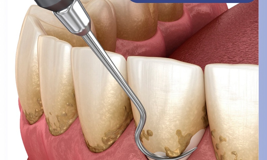 Image 3: Comprehensive Dental Checkup with X-Rays and Cancer Screening