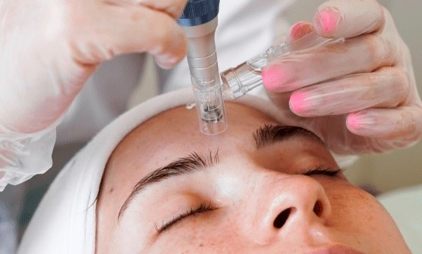 Image 5: Up to 62% Off on Spa / Salon Beauty Treatments at Pretty Sugar Salon