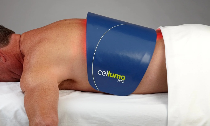 Image 3: Up to 80% Off on Acupuncture and Cupping at Core Meridian